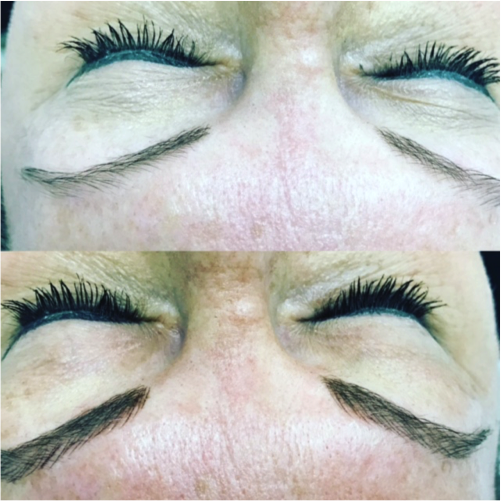Can you explain microblading?