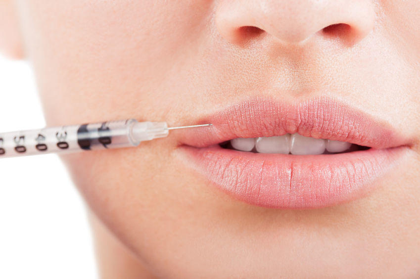Lip Injections