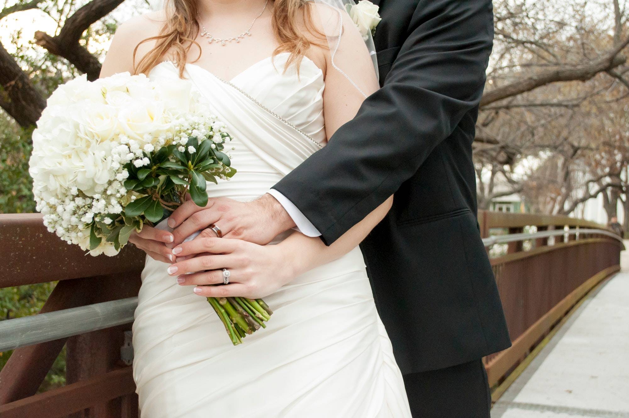 Pre-Wedding Plastic Surgery: 5 Elements of the Bridal Blueprint