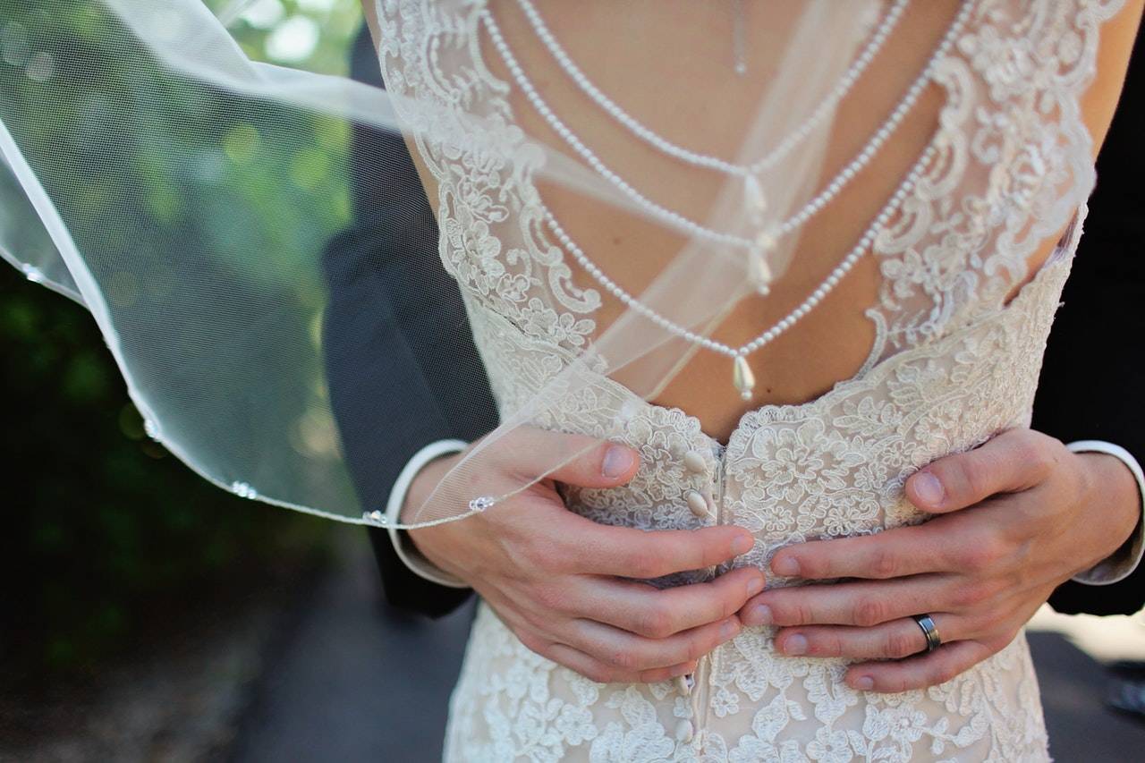 Should I Get Botox Before My Wedding? It’s My First Time!