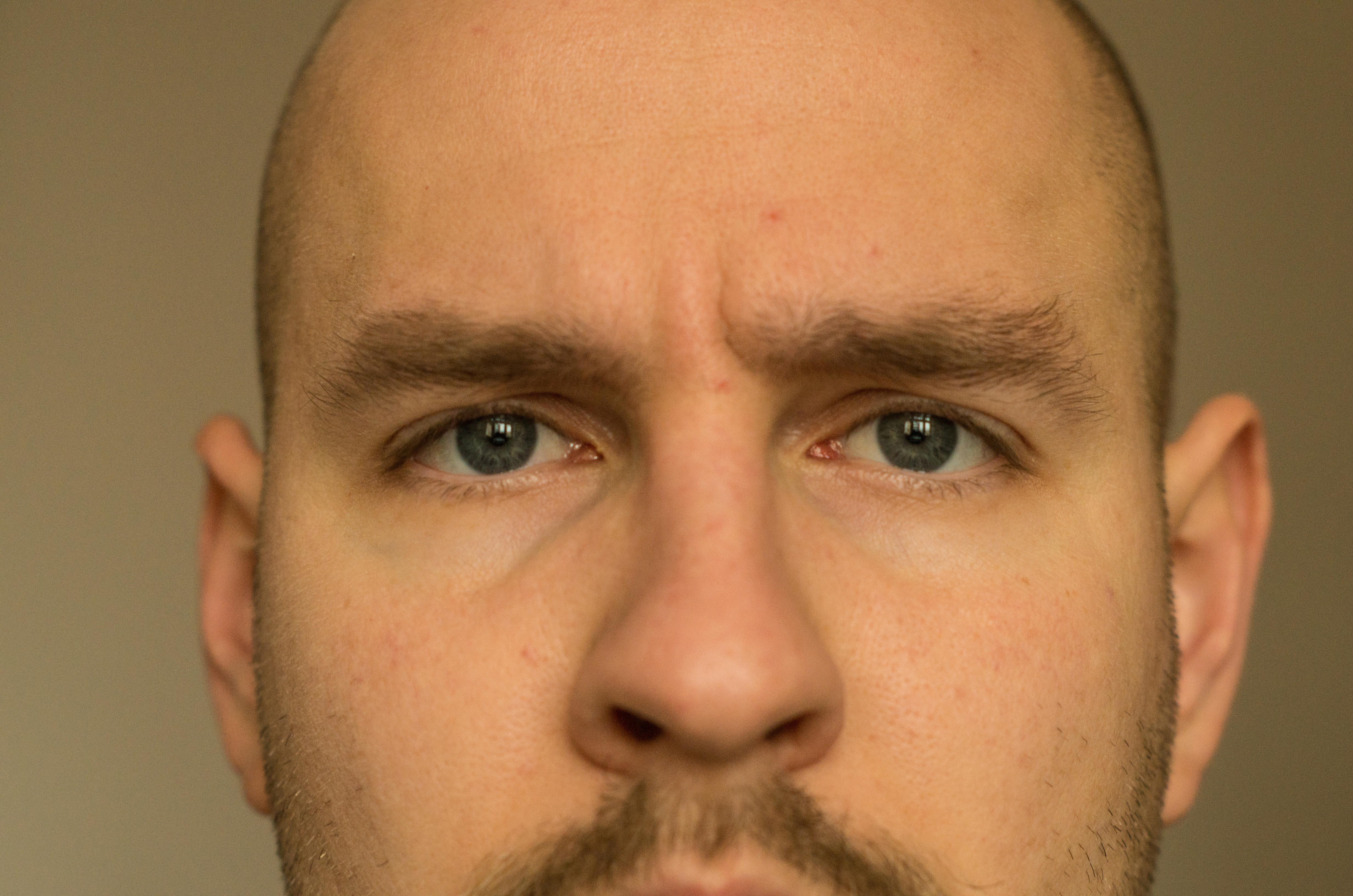Q&A: Male Procedures