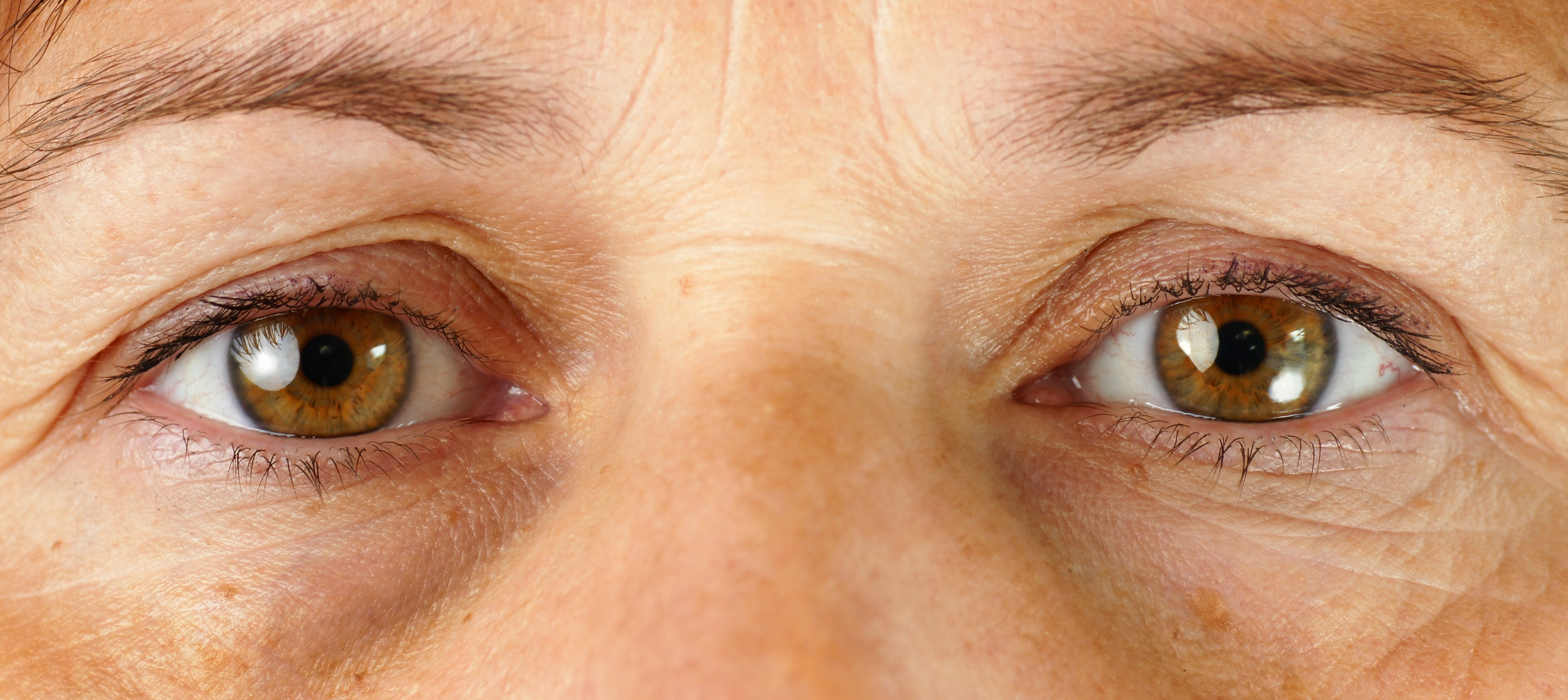 The Eyes Have It: Surgical vs. Non-Surgical Correction