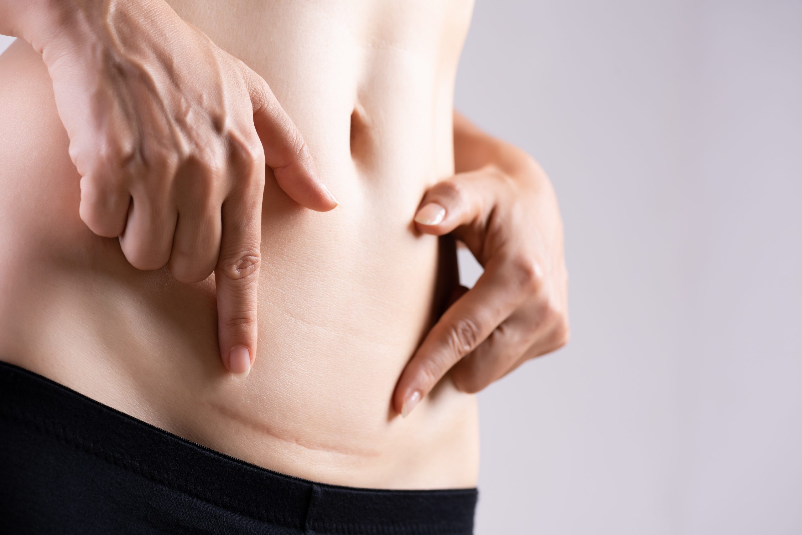July 2020 Procedure of the Month: Wound healing